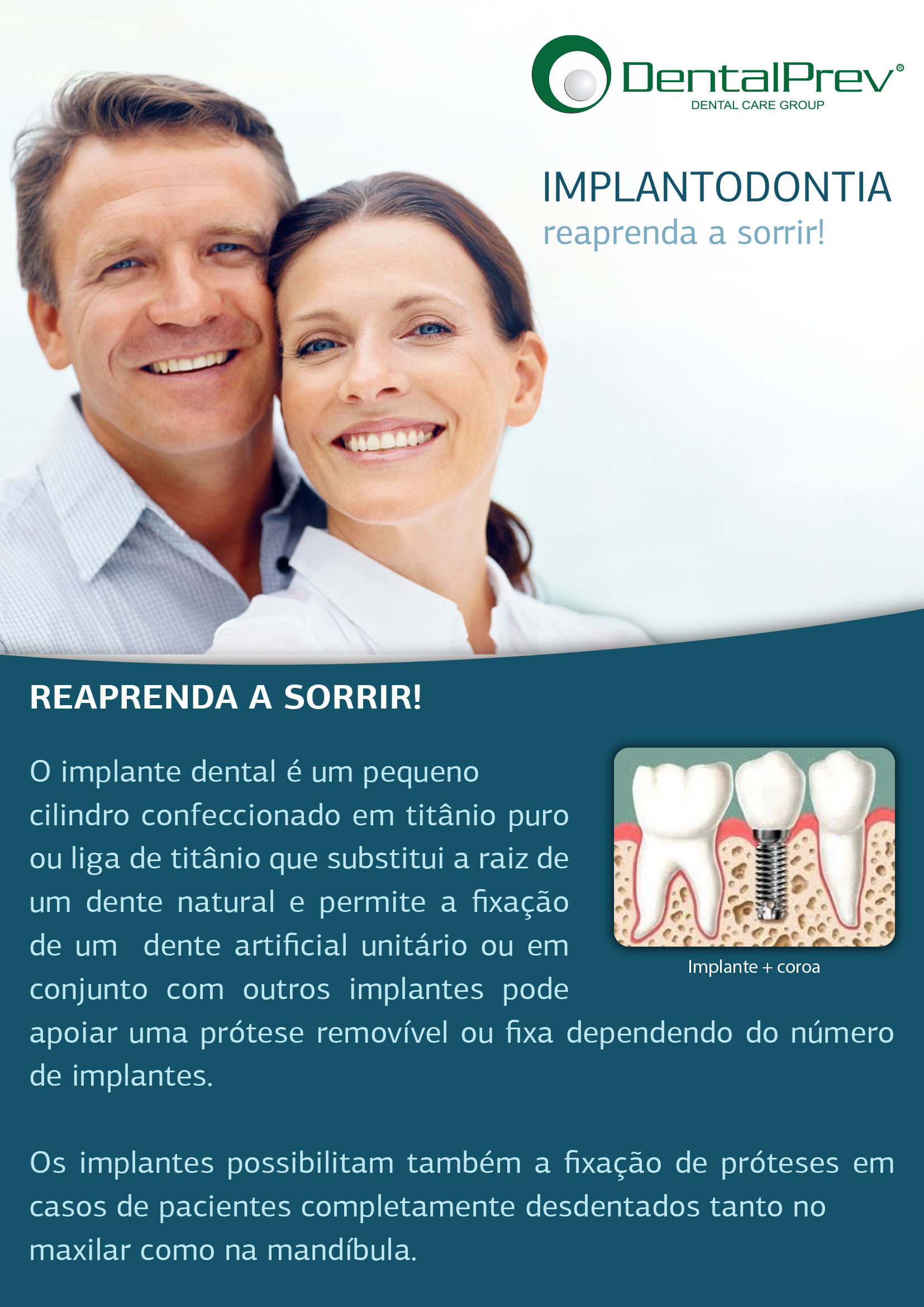 Implantes dentários